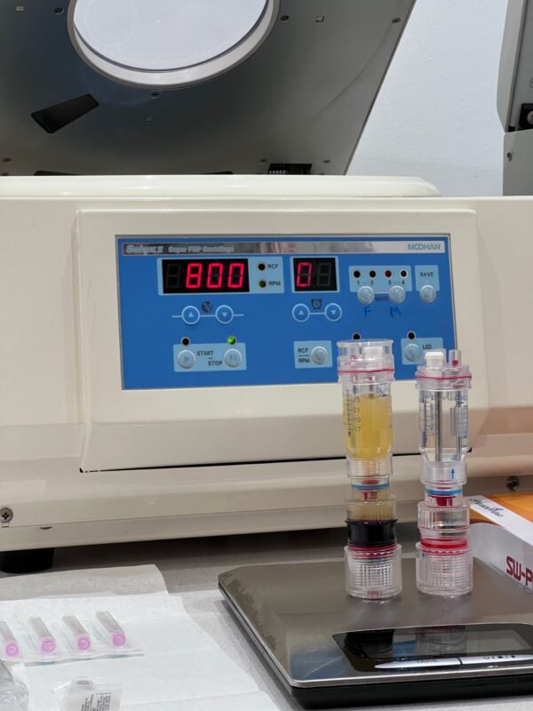 plasma